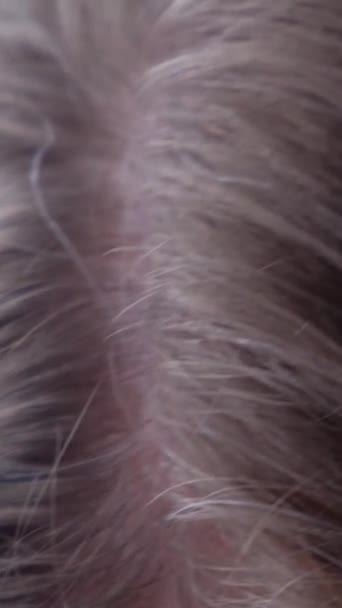 若い女性の頭の上の初期の灰色の髪のクローズアップ 灰色の髪の問題 バーティカルビデオ — ストック動画