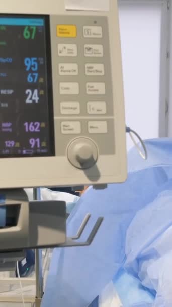 一位老年妇女在手术台上由合格的外科医生仔细观察 静脉曲张手术 垂直录像 — 图库视频影像
