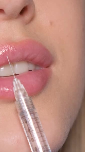 Beautician Makes Injection Beauty Lips Beautiful Patient Rejuvenating Beauty Procedure — Stock Video