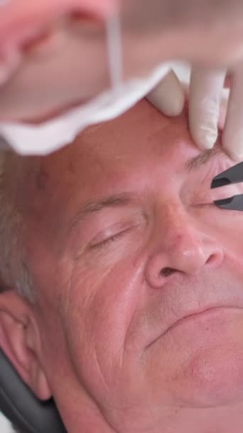 プラスチック外科医は 目の領域の賢い皮膚を検査し キャリパーでそれを測定します 高齢者の顔にプラスチック手術の準備 バーティカルビデオ — ストック動画