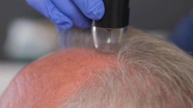 Saç ve kafa derisinin mikroskobik incelemesi için teşhis kompleksinin yakın çekimi. Saç problemleri.