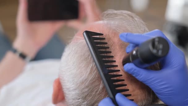 Bir Tricholog Kafa Derisinin Kılını Derisini Inceliyor Kırılgan Saç Dökülmüş — Stok video