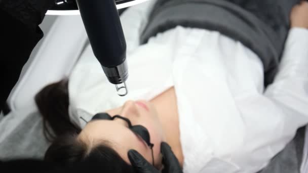 Ein Junges Mädchen Bekommt Einem Schönheitssalon Ein Carbon Gesichtspeeling Laserimpulse — Stockvideo