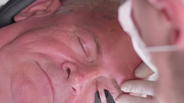 プラスチック外科医は 目の領域の賢い皮膚を検査し キャリパーでそれを測定します 高齢者の顔にプラスチック手術の準備 バーティカルビデオ — ストック動画
