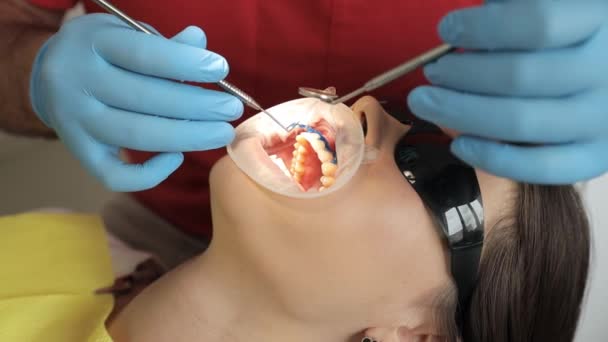 Ένα Κοντινό Πλάνο Ενός Οδοντιάτρου Που Χρησιμοποιεί Ιατρικό Εξοπλισμό Συνεργάζεται — Αρχείο Βίντεο