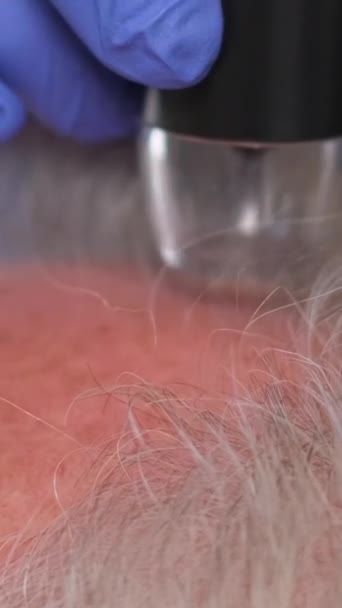 Közelkép Diagnosztikai Komplexum Mikroszkopikus Vizsgálata Haj Bőr Fejbőr Hajproblémák Függőleges — Stock videók