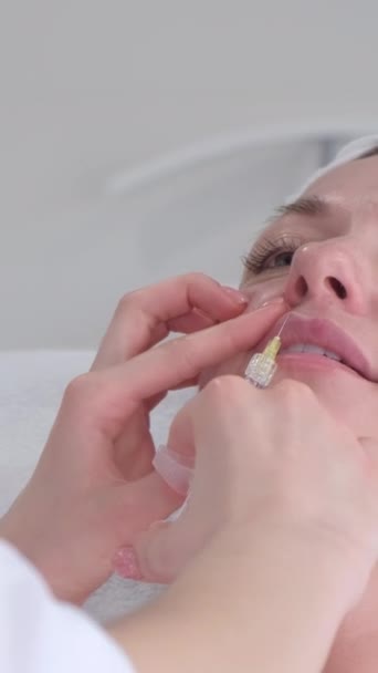 Μια Όμορφη Γυναίκα Λαμβάνει Ενέσεις Στα Χείλη Της Από Έναν — Αρχείο Βίντεο