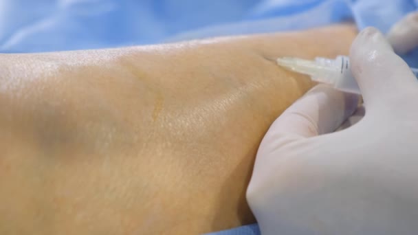 Doctor Assistant Perform Surgical Intervention Varicose Veins — Stock Video