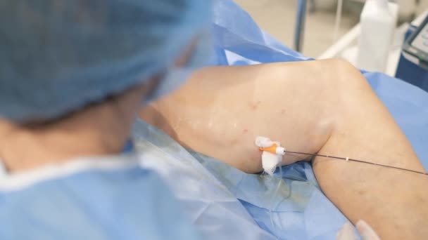 Médico Asistente Realizan Una Intervención Quirúrgica Para Las Venas Varicosas — Vídeos de Stock