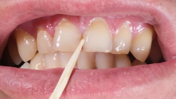 Gros Plan Homme Utilisant Cure Dent Pour Laver Les Dents — Video