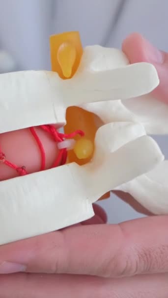 Omurganın Arka Kısmındaki Plastik Modelin Yakın Çekimi Doktor Omurilik Fıtığının — Stok video