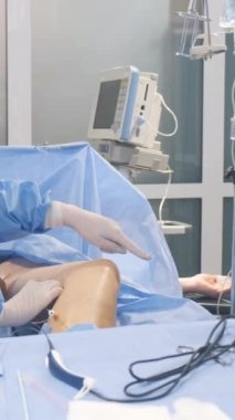 Damarları çıkarmak için yapılan ameliyat sırasında bir cerrah ekibi - flebektomi. Klinikte cerrahi operasyon. Dikey video.