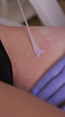 Güzel bir kadın şekerli tüy dökücü güzellik tedavisi görüyor. Bikini tüy dökücü ağda. Usta kuaförde tüy döküyor. Dikey video.