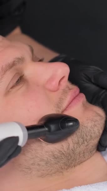 在美容院接受射频整容的大胡子男子的特写镜头 男人接受年轻的面部整容 面部按摩和皮肤护理 垂直录像 — 图库视频影像