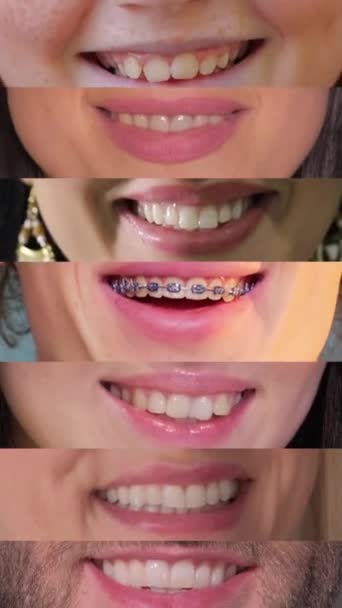 Video Collage Vertical Personas Con Una Hermosa Sonrisa Clínica Dental — Vídeo de stock
