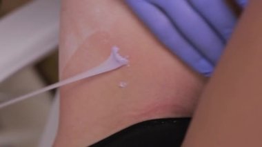 Güzel bir kadın şekerli tüy dökücü güzellik tedavisi görüyor. Bikini tüy dökücü ağda. Usta kuaförde tüy döküyor. Dikey video.