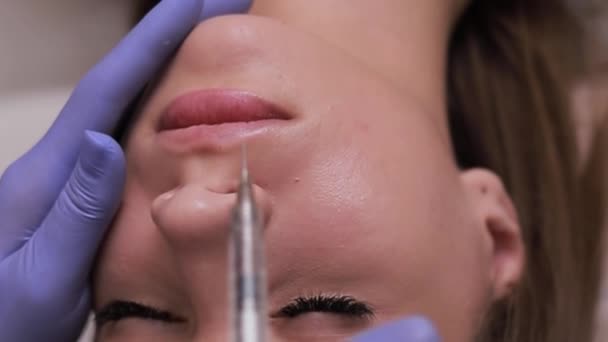 Close Processo Aumento Lábios Cosméticos Injeção Médica Para Lábios Grandes — Vídeo de Stock