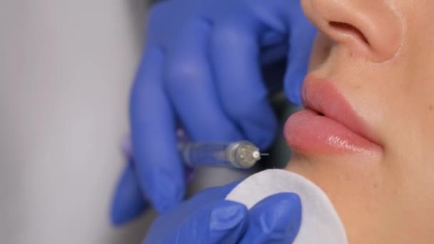 Zamknąć Ręce Kosmetologa Wykonującego Wstrzyknięcie Botoksu Usta Kobiety Trzyma Strzykawkę — Wideo stockowe