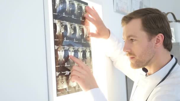 Een Vertebroloog Onderzoekt Röntgenfoto Van Menselijke Botten Ray Van Wervelkolom — Stockvideo