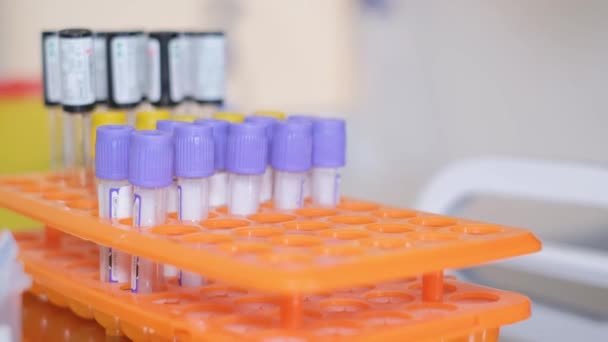 다양한 액체로 채워진 플라스틱 테스트 세트는 실험실 장비와 비슷한 오렌지 — 비디오