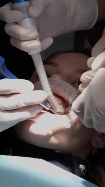 Personerna Tänder Undersöks Tandläkare Med Gester Och Fingrar Inne Dentalbyggnad — Stockvideo
