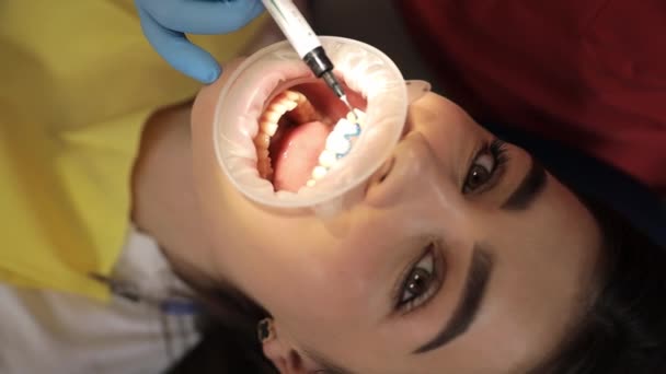 Tandarts Onderzoekt Vrouwen Tanden Met Inachtneming Van Haar Voorhoofd Neus — Stockvideo