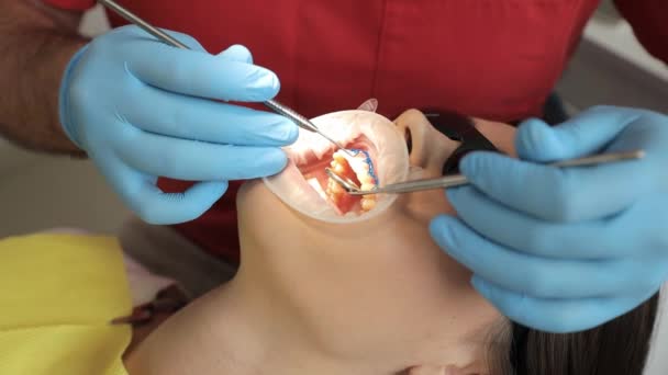 Використовуючи Руки Очі Медичне Обладнання Стоматолог Оглядає Зуби Пацієнтів Щелепу — стокове відео