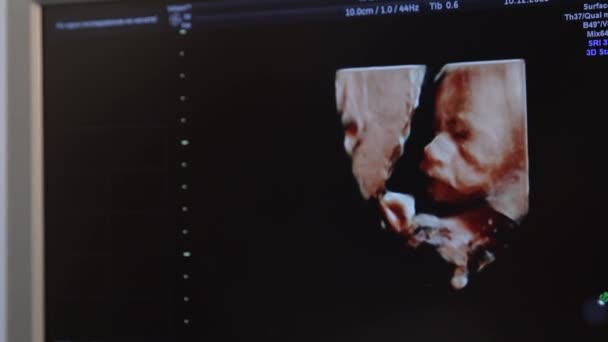 对胎儿进行超声4D检查 现代医疗设备 医药和保健概念 图四D显示母亲子宫中婴儿的超声图像 — 图库视频影像