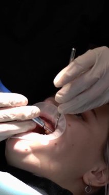 Bir dişçi, dişlerinin sağlığını kontrol etmek için kadının dişlerini, parmağını, başparmağını ve hareketlerini kullanıyor..