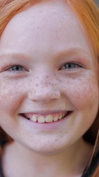 Szczęśliwa Młoda Dziewczyna Rudymi Włosami Piegami Uśmiechnięta Czołem Nosem Policzkiem — Wideo stockowe