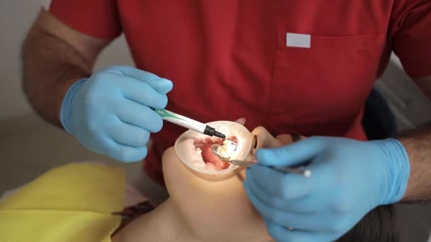 Het Proces Van Tandheelkundige Behandeling Van Een Jonge Vrouw Liggend — Stockvideo