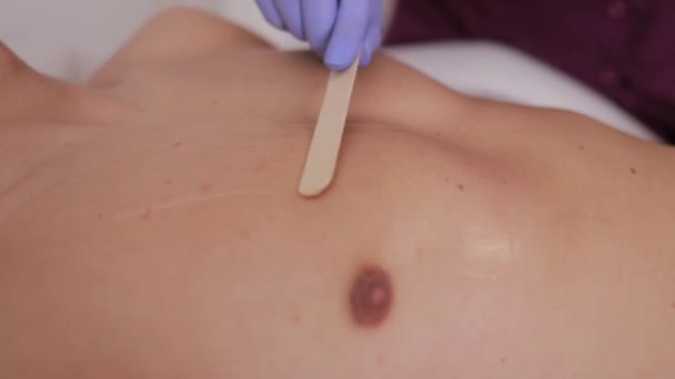 Vídeo Mostrando Pessoas Recebendo Tratamentos Depilação Peito Usando Várias Técnicas — Vídeo de Stock