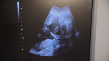 Ekranda hamile bir kadının teşhisi altında ceninin ultrasonunun videosu var. Hamilelik testi. Ultrason sırasında cenin hareketleri