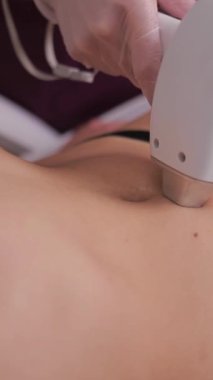 Estetik tıpta lazer. Epilasyon. Lazer tüy temizleme tedavisi gören bir kadın. Baldırları ve bikini bölgesi. Güzellik uzmanı lazer kullanarak bikini bölgesindeki kılları alıyor. dikey video