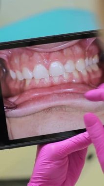 Modern bir diş muayenehanesinde, bir dişçi hastaların dişlerinin akıllı telefon görüntülerini pembe eldiven giyerken alır ve dişlerinin sağlığını kontrol eder.