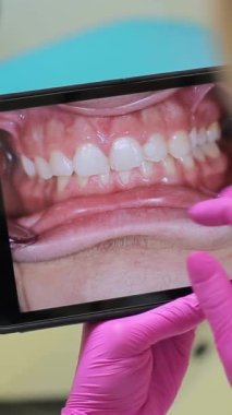 Modern bir diş muayenehanesinde, bir dişçi hastaların dişlerinin akıllı telefon görüntülerini pembe eldiven giyerken alır ve dişlerinin sağlığını kontrol eder.