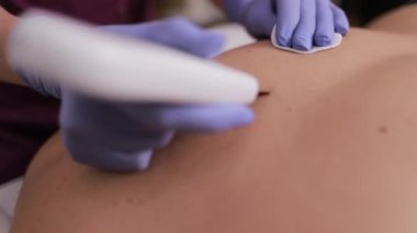Gelişmiş sağlık hizmetleri uygulamaları gösteren, bir hastanın sırtında tedavi amaçlı ultrason uygulayan profesyonel bir doktor..