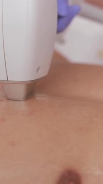 Tıbbi bir kaplıcada erkekleri hedef alan estetik hizmetlerin büyümesini vurgulayan gençleştirici bir tedavi. Dikey video.