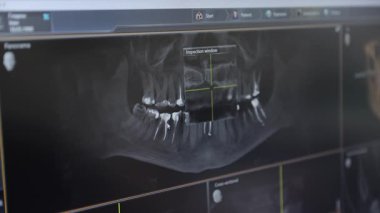 Gelişmiş bir diş röntgeni görüntüsü hem karmaşık çene yapısını hem de diş hizalamasını etkin bir şekilde ortaya koyar