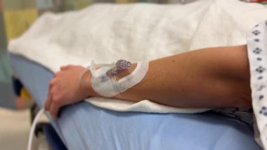 Bir hastanın kolunda damardan damar yolu açılması, klinik bir ortamda sağlık ve bakımı vurguluyor.