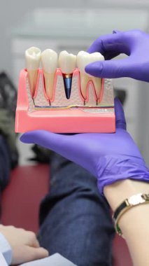 Diş hekiminde muayene sırasında hastaya diş modelini gösteren bir diş hekimi. Dikey video. 