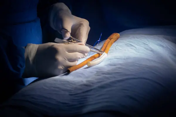 Cerrah damar stenti dikiyor.