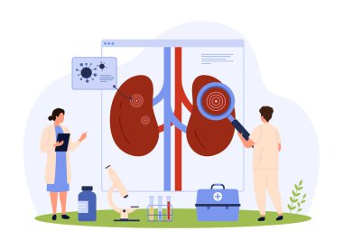 Pyelonefrit, böbrek enfeksiyonu teşhisi ve tedavi, nefroloji vektör çizimi. Çizgi filmlerdeki küçük insanlar idrar sistemi sağlığını büyüteç, araştırma kronik hastalıkları ve bakterilerle kontrol ediyorlar.