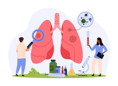 Akciğer hastalığının teşhisi, pulmonoloji vektör çizimi. Çizgi filmlerdeki küçük insanlar hastaların akciğerlerini solunum sistemi muayenesinde büyüteçle kontrol eder. Pulmonologlar organ muayenesi yapar.