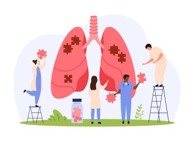 Akciğer sağlığı, pulmonoloji vektör çizimi. Karikatürlerdeki küçük insanlar insan ciğerlerine yerleştirmek için yapboz parçaları tutuyorlar, doktorlar hastayı solunum enfeksiyonlarından, zatürreeden ve tüberkülozdan koruyorlar.