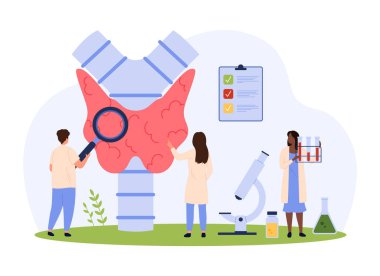 Endokrinoloji vektör illüstrasyonunda tiroid hastalıklarının teşhisi. Çizgi filmlerdeki küçük insanlar endokrin organın sağlığını ve işlevini büyüteçle kontrol eder, hipotiroidizm veya hipertiroidizm teşhisi koyar.