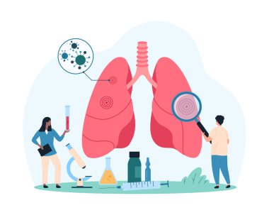 Solunum sistemi enfeksiyonları, akciğer hastalıkları. Büyüteçle küçük insanlar, insan akciğerini bilgi anatomisi grafiği üzerinde inceleyip bakteri ve virüs vektör çizimleri için kontrol ederler.