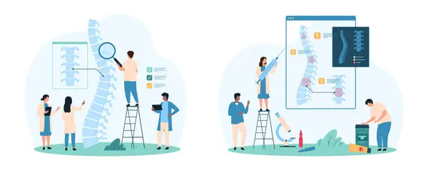 stock vector Diagnosis and treatment of spinal column diseases. set. Tiny people check for inflammation in human intervertebral discs on medical anatomy chart and xray of patient cartoon vector illustration