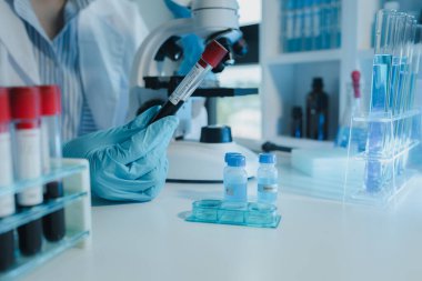 Kimyager kandaki kimyasalları araştırmak için mikroskop kullanıyor. Bilim adamı laboratuvarda kimyasallarla deney yapıyor. Kimyager test tüplerindeki kimyasalları kimyasal reaktörlerle ayırıyor.,