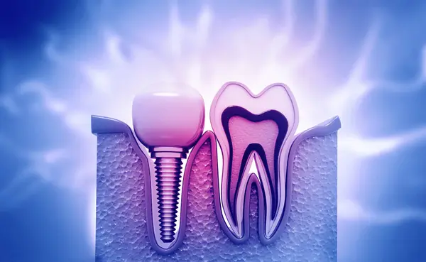 Implemento Dental Sobre Fondo Médico Abstracto Ilustración —  Fotos de Stock